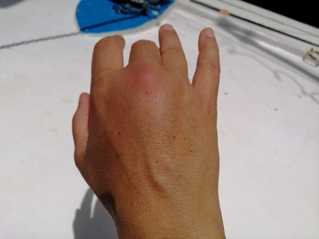 main de chatoune infectée